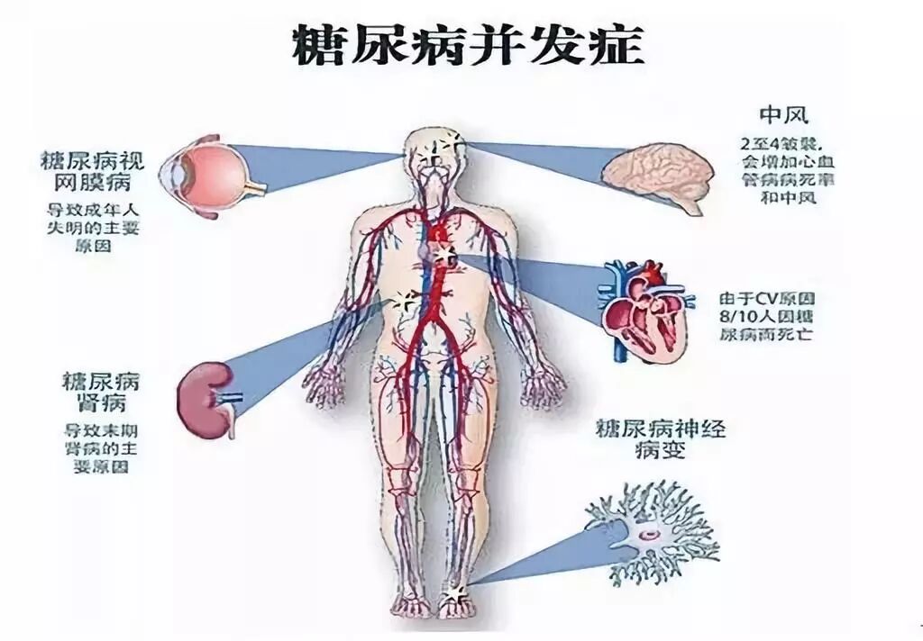SOD与健康:揭秘SOD对糖尿病的重要作用(pic3) SOD与健康 |SOD对糖尿病的作用
