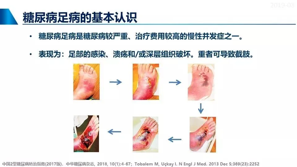 【上海复旦大学药学院】刺梨活性成分抗糖尿病的研究报告！(pic22)